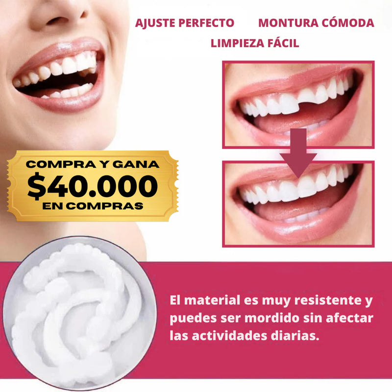 (COMPRA Y GANA) Carillas Dentales Snap-On Smile – Sonrisa Más Atractiva al Instante