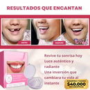 (COMPRA Y GANA) Carillas Dentales Snap-On Smile – Sonrisa Más Atractiva al Instante