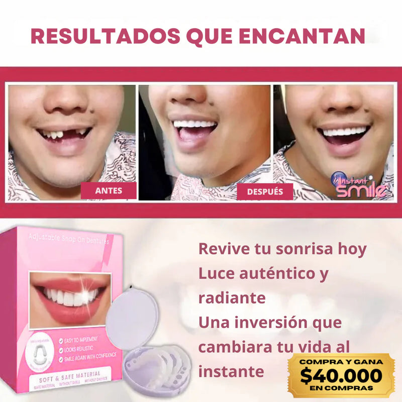 (COMPRA Y GANA) Carillas Dentales Snap-On Smile – Sonrisa Más Atractiva al Instante