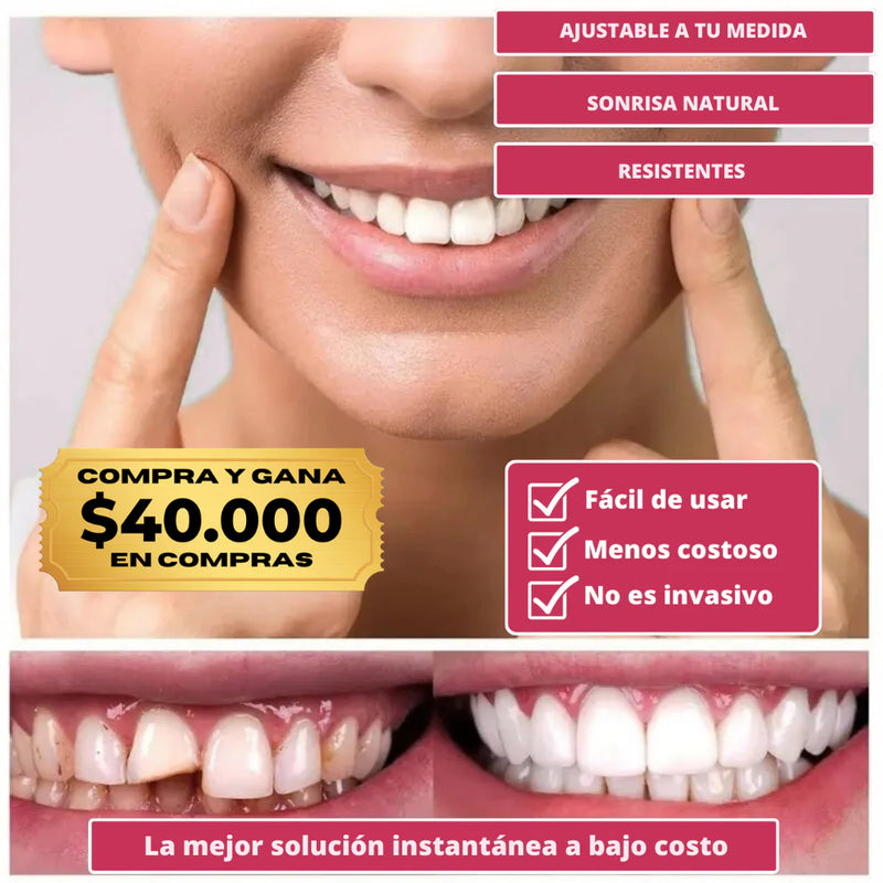(COMPRA Y GANA) Carillas Dentales Snap-On Smile – Sonrisa Más Atractiva al Instante